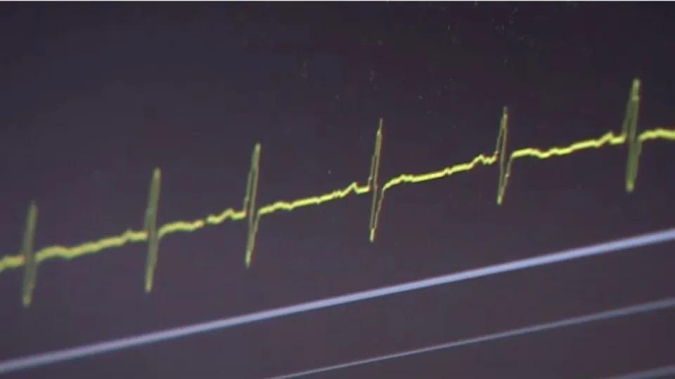 聚焦真相／國人頭號健康殺手！ 心血管飲食解密〖  東森新聞